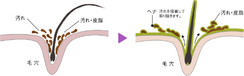 ヘナで地肌が綺麗に！